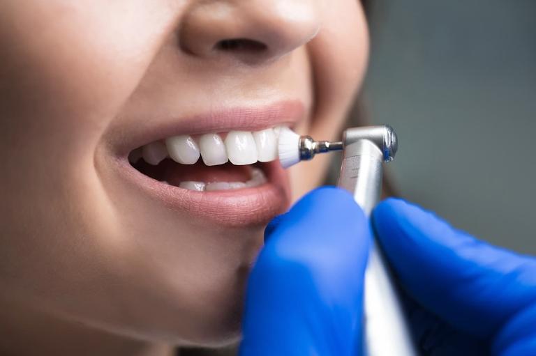 Wenn die häusliche Mundhygiene an ihre Grenzen stößt: Professionelle Zahnreinigung und Individualprophylaxe bei Dr. Schmalhofer & Kollegen in Regensburg.